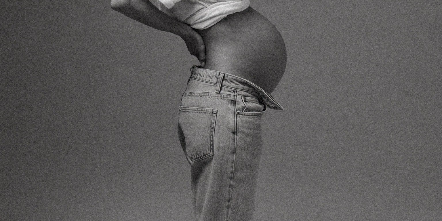 Can You Avoid Stretch Marks During Pregnancy? Here's What the Evidence Says and My Hot Take